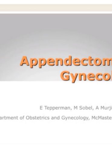 Appendectomy in Gynecology