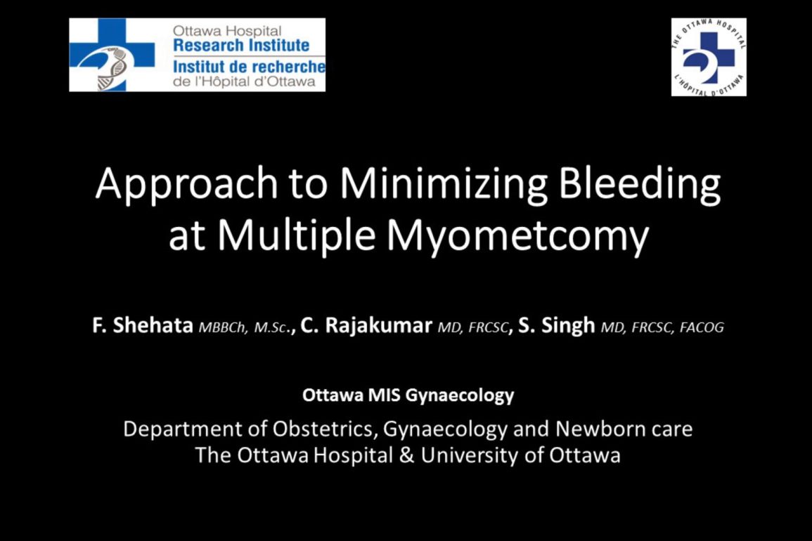 Approach to Minimizing Bleeding at Multiple Myomectomy