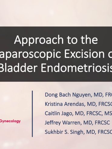 Approach to the Laparoscopic Excision of Bladder Endometriosis