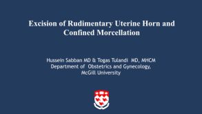 Excision of Rudimentary Uterine Horn and Confined Morcellation 23 Excision of Rudimentary Uterine Horn and Confined Morcellation
