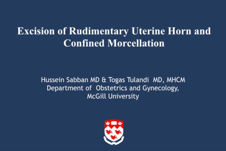 Excision of Rudimentary Uterine Horn & Confined Morcellation