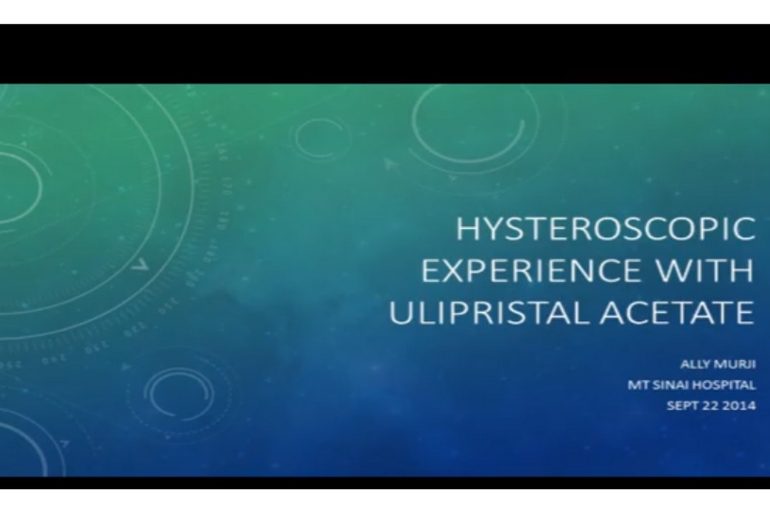 Hysteroscopic Experience with Ulipristal Acetate