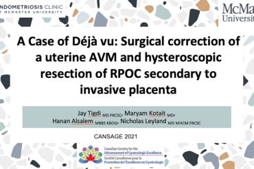 Surgical Correction of a Uterine AVM and Hysteroscopic Resection of RPOC Secondary
