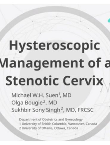 Hysteroscopic Management of a Stenotic Cervix