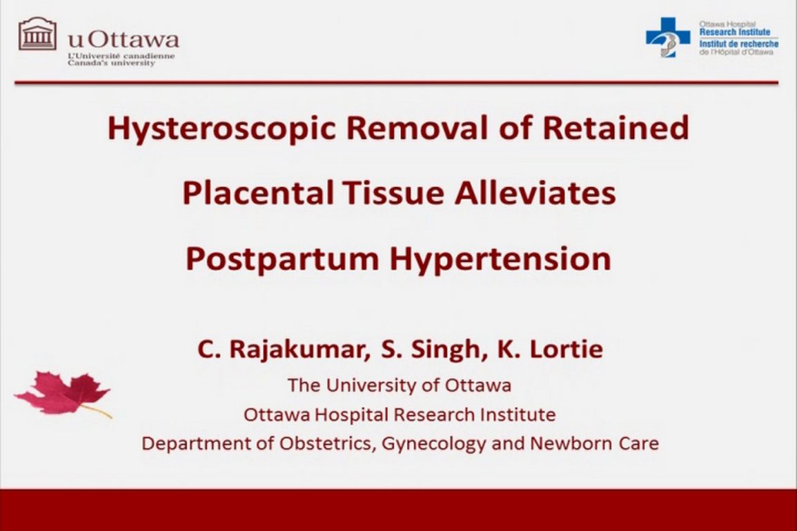 Hysteroscopic Removal of Retained Placental Tissue Alleviates Postpartum Hypertension