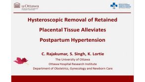 Hysteroscopic Removal of Retained Placental Tissue Alleviates Postpartum Hypertension