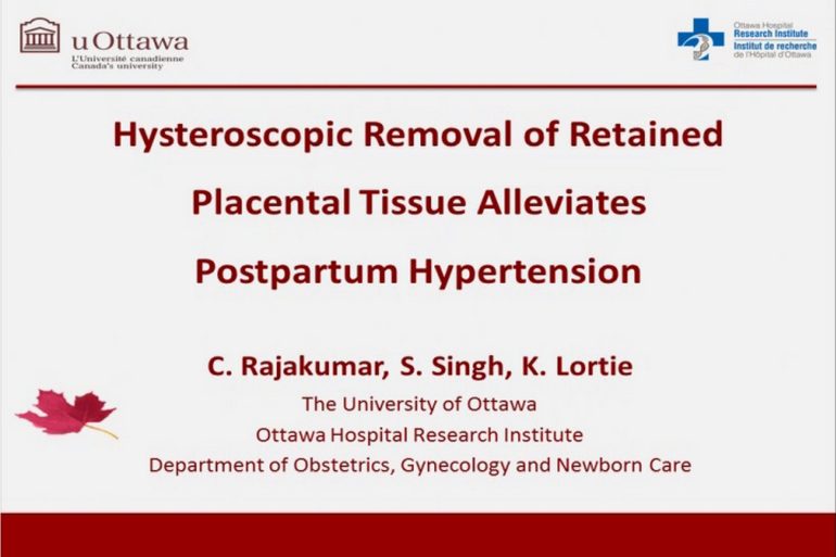 Hysteroscopic Removal of Retained Placental Tissue Alleviates Postpartum Hypertension