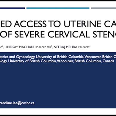 IR-Guided Access to Uterine Cavity in a Case of Severe Cervical Stenosis