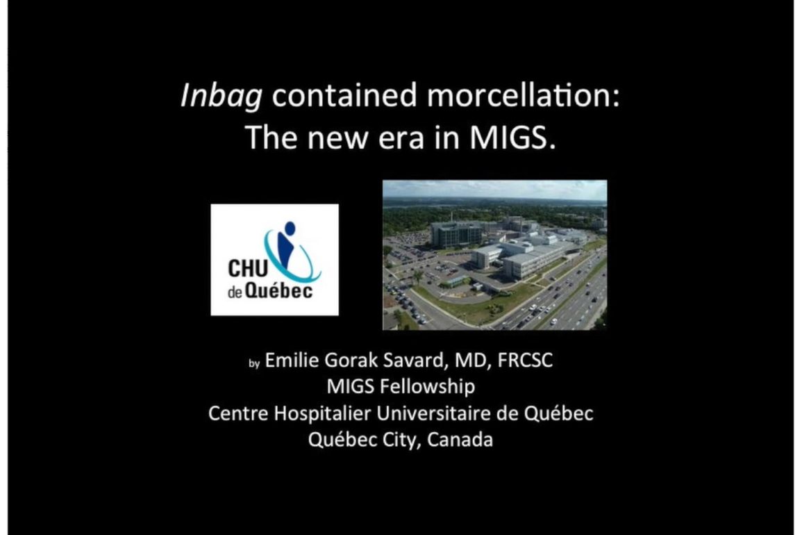 Inbag Contained Morcellation The New Era in MIGS