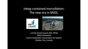 Inbag Contained Morcellation: The New Era in MIGS 28 Inbag Contained Morcellation The New Era in MIGS