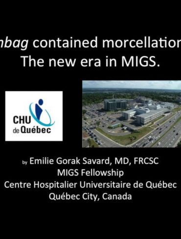 Inbag Contained Morcellation The New Era in MIGS