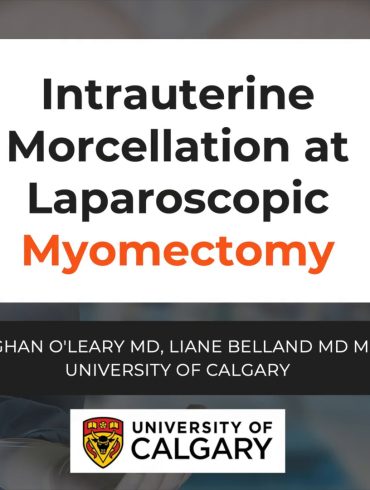 Intrauterine Morcellation at Laparoscopic Myomectomy