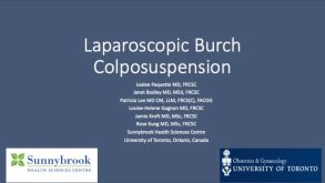 Laparoscopic Burch Colposuspension