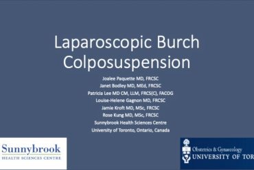 Laparoscopic Burch Colposuspension