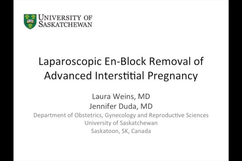 Laparoscopic En-Block Removal of Advanced Interstitial Pregnancy