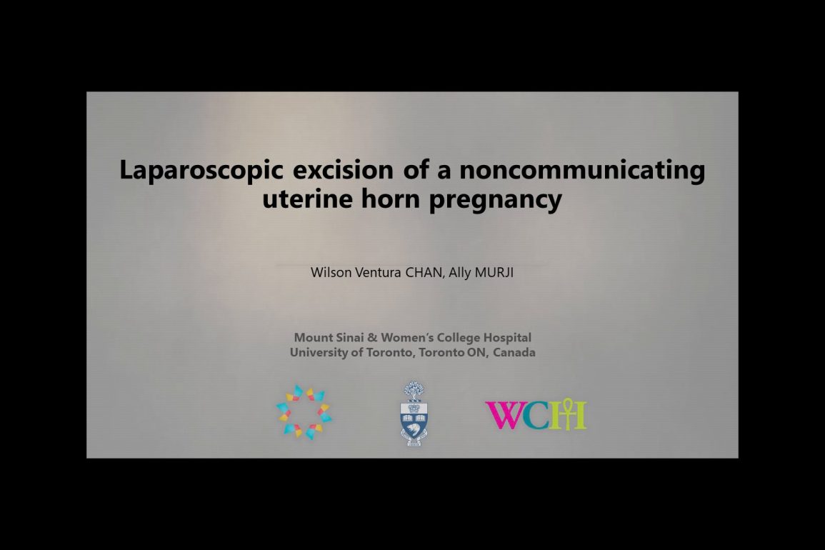 Laparoscopic Excision of Noncommunicating Uterine Horn Pregnancy