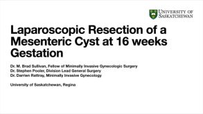 Laparoscopic Excision of a Mesenteric Cyst at 16 Weeks Gestation