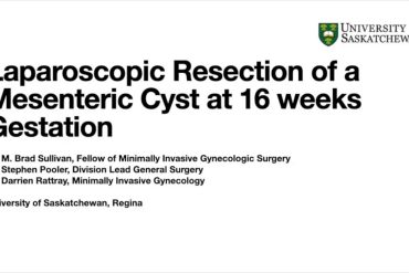 Laparoscopic Excision of a Mesenteric Cyst at 16 Weeks Gestation
