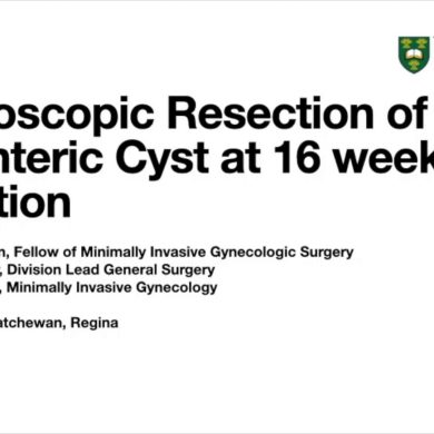 Laparoscopic Excision of a Mesenteric Cyst at 16 Weeks Gestation