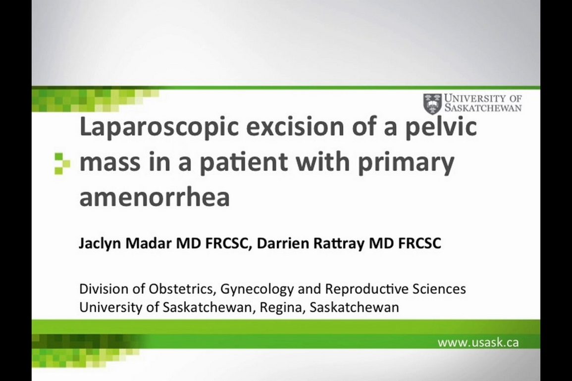 Laparoscopic Excision of a Pelvic Mass in a Patient with Primary Amenorrhea