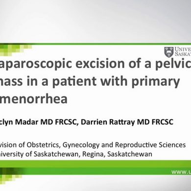 Laparoscopic Excision of a Pelvic Mass in a Patient with Primary Amenorrhea