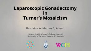 Laparoscopic Gonadectomy in Turner's Mosaicism