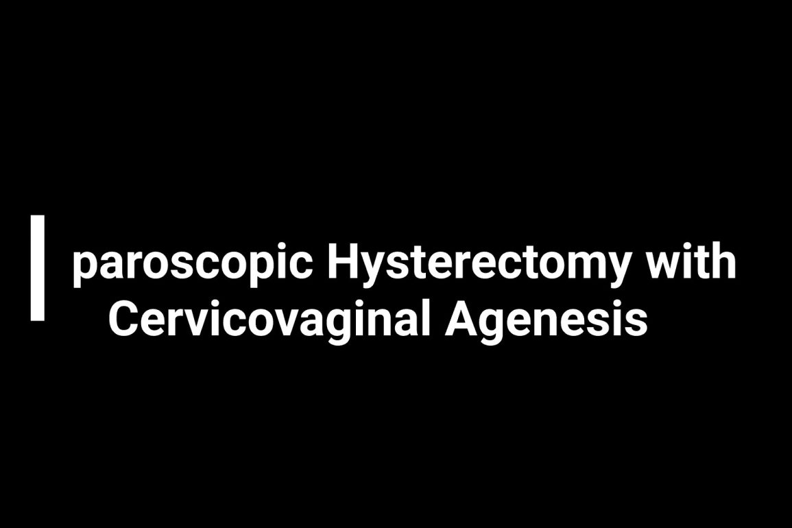 Laparoscopic Hysterectomy with Cervicovaginal Agenesis