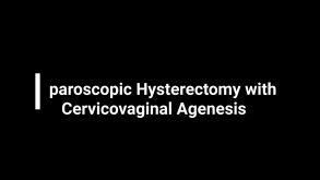 Laparoscopic Hysterectomy with Cervicovaginal Agenesis 20 Laparoscopic Hysterectomy with Cervicovaginal Agenesis