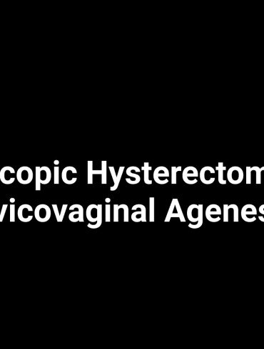 Laparoscopic Hysterectomy with Cervicovaginal Agenesis
