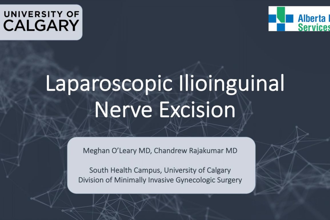 Laparoscopic Ilioinguinal Nerve Excision