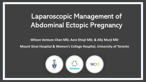 Laparoscopic Management of Abdominal Ectopic Pregnancy