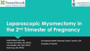 Laparoscopic Myomectomy in the 2nd Trimester of Pregnancy