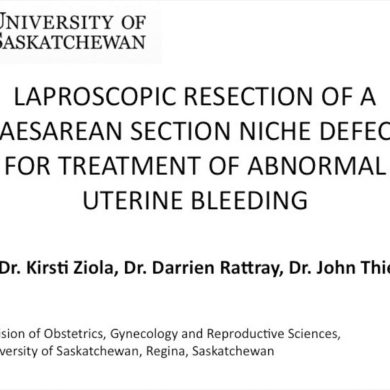 Laparoscopic Resection of a Caesarean Section Niche Defect for Treatment of Abnormal Uterine Bleeding