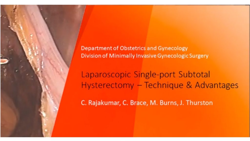 Laparoscopic Single-Port Subtotal Hysterectomy