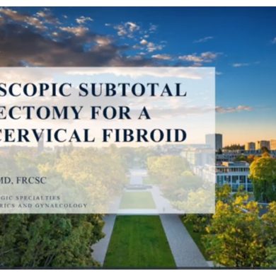 Laparoscopic Subtotal Hysterectomy for a Large Cervical Fibroid