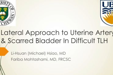 Lateral Approach to Uterine Artery & Scarred Bladder in Difficult TLH
