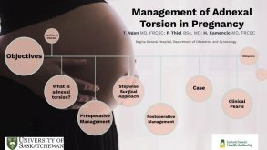 Management of Adnexal Torsion in Advanced Pregnancy