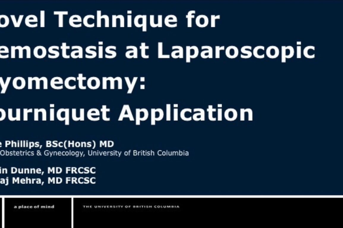 Novel Technique for Hemostasis at Laparoscopic Myomectomy Tourniquet Application