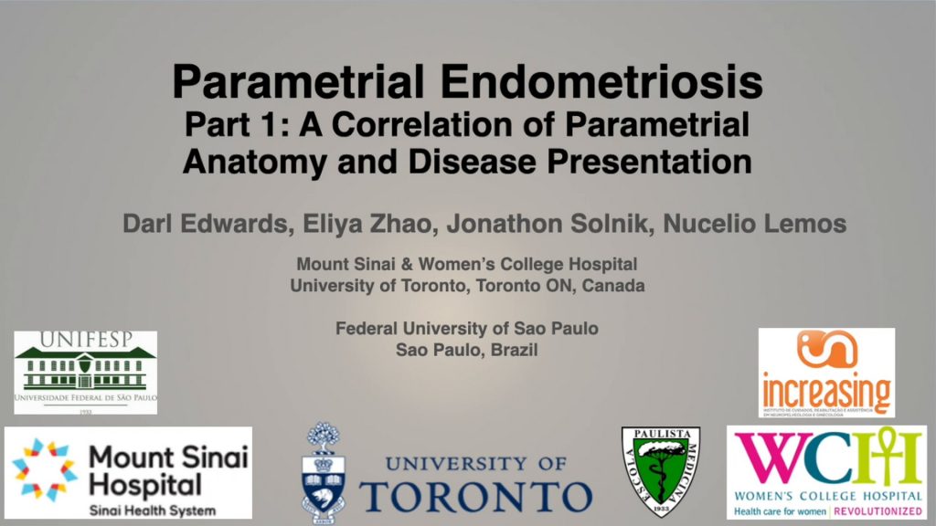 A Correlation of Parametrial Anatomy & Disease Presentation