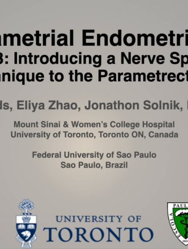 Parametrial Endometriosis Part 3 Introducing a Nerve Sparing Technique to the Parametrectomy