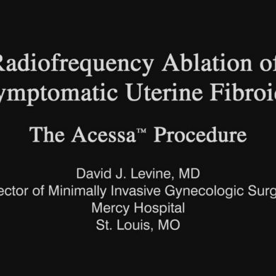 Radiofrequency Ablation of Symptomatic Uterine Fibroids The Acessa Procedure