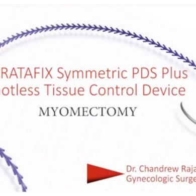 STRATAFIX Symmetric PDS Plus Knotless Tissue Control Device Myomectomy