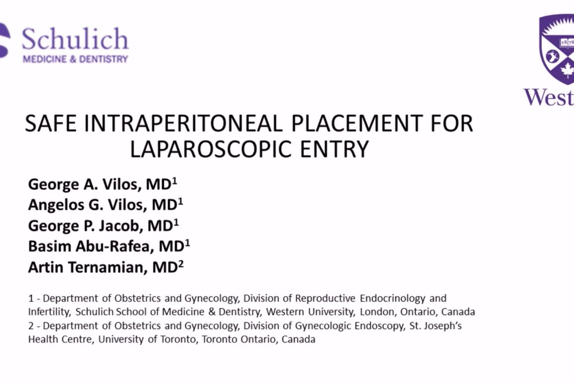 Safe Intraperitoneal Placement for Laparoscopic Entry