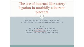 The Use of Internal Iliac Artery Ligation in Morbidly Adherent Placenta