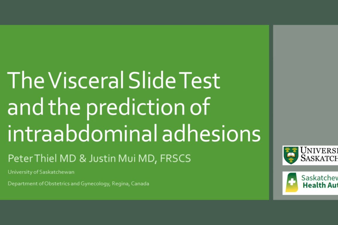 The Visceral Slide Test and the Prediction of Intraadominal Adhesions