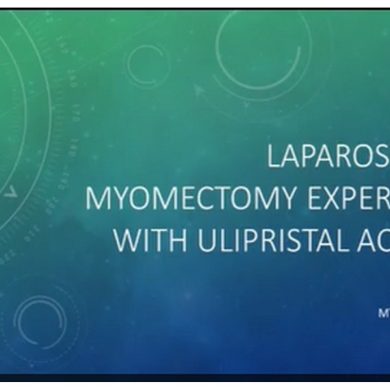 This video outlines one surgeon’s laparoscopic experience with ulipristal acetate at myomectomy.