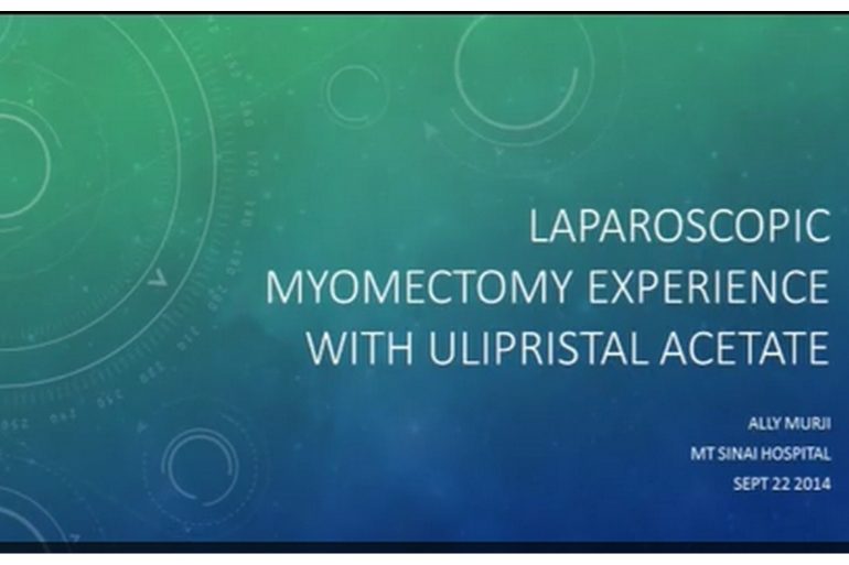 This video outlines one surgeon’s laparoscopic experience with ulipristal acetate at myomectomy.
