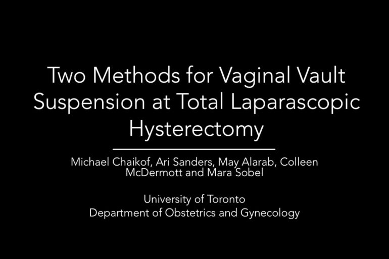 Two Methods for Vaginal Vault Suspension CanSAGE Videos