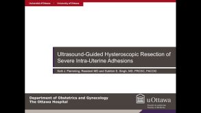 Ultrasound-Guided Hysteroscopic Resection of Severe Intra-Uterine Adhesions 41 Ultrasound-Guided Hysteroscopic Resection of Severe Intra-Uterine Adhesions