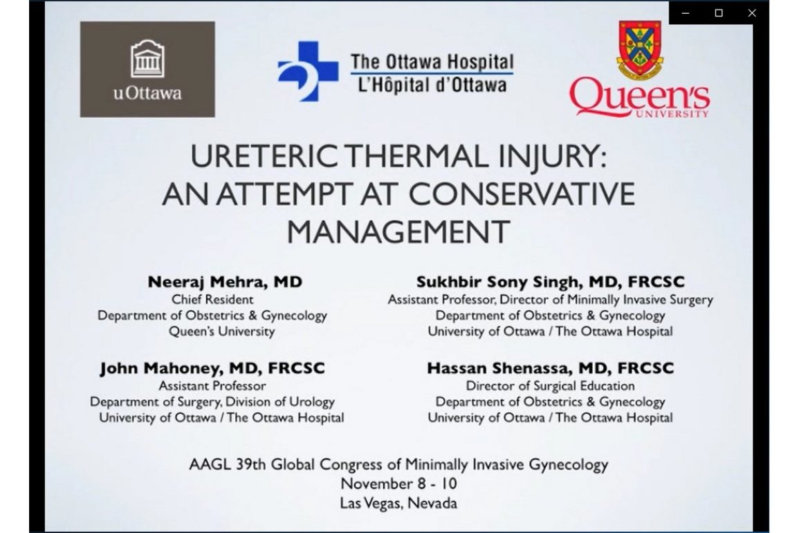 Ureteric Thermal Injury An Attempt at Conservative Management
